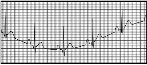 Fig 3: Wavelet Decomposition Structure 