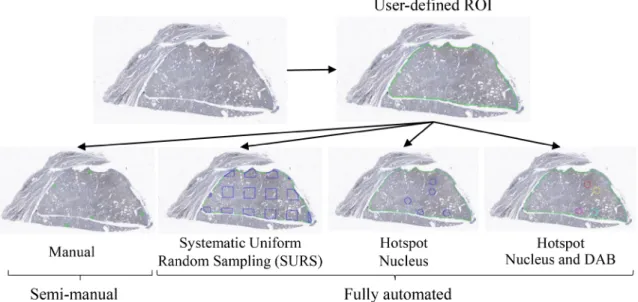 Figure 6: Tumor sampling methods. Upon receiving digital whole slide images, an operator delineated the tumor tissue (ROI)