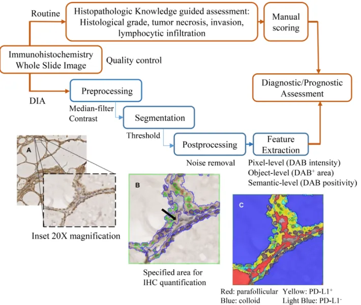 Figure 3: Overview of the DIA pipeline and histomorphological approach. The DIA developed in this study (blue/bottom  panel) is compared with the histopathology-based assessment (red/top panel)