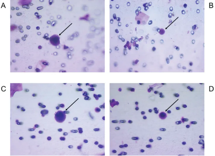 Figure 1: Examples of morphological features of CRC with corresponding VHL alterations