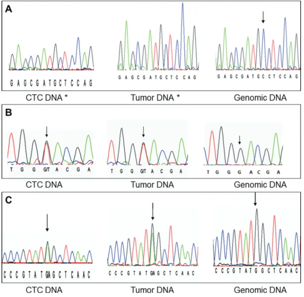 Figure 2: Examples of matching DNA profiles.  (A) exon 3 codon 163 (c.486delC); (B) exon 1 codon 9 (c.27G>T); (C) exon 1  codon 88 (c.263G>A)