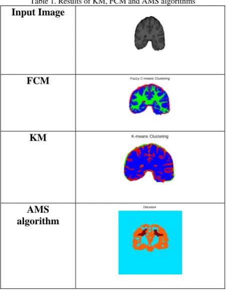 Table 1. Results of KM, FCM and AMS algorithms Input Image 
