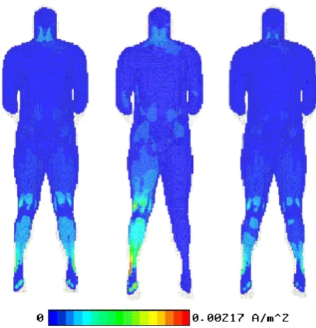 Fig. 5. Differences between real parts of the induced current densi-ties in a section of the body computed with isotropic and anisotropic(natural orientation) muscles for the cases: left – both feet touch theground, middle – only one foot touches the ground, right – both feetisolated from ground.