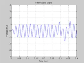 Fig. 17: ECG signal after filtration with the adaptive filter   