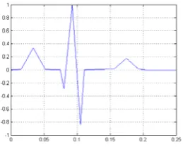 Fig. 1a: Normal ECG waveform  Kaiser Window Function 