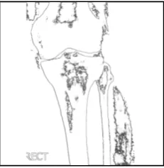 Figure 5: Edge Detection 