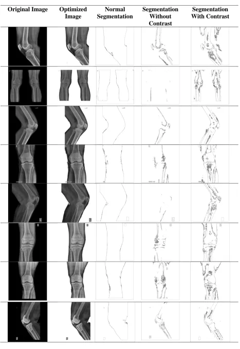 Table 1: A Comparison of Results seen of the Test Images with Different Techniques 