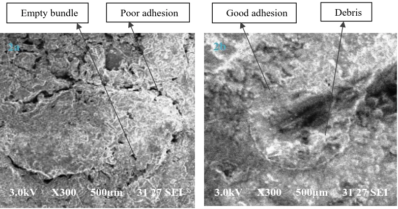 Fig.  2 a & b - SEM micrographs of raw and alkali treated Borassus fruit fiber reinforced epoxy composites 