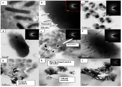 FIG. 8.  TEM micrograph, a) Intact E.coli cell; b), c), E.coli & S.aureus cell internalization by 3vol% hexagonal thin plate, d) E.coli cell internalization, e) S.aureus cell internalization due to 7vol% assembled thin plate, f) E.coli cell internalization, g), h), i) S.aureus cell internalization due to nanotetrapod structure 