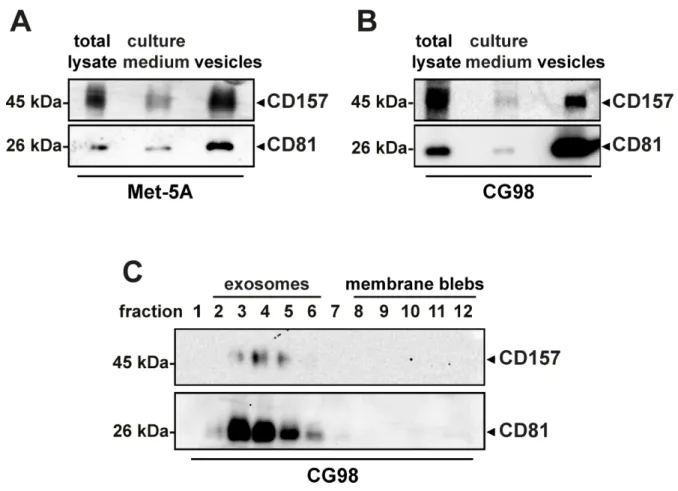 Figure 2: Analysis of CD157 expression in vesicles released by mesothelial cells.  Western blot analysis of CD157 expressed  in total cell lysate (30 µg/lane), cell culture medium (1 ml, TCA precipitated) and vesicles (30 µg/lane) from (A) non-malignant Me