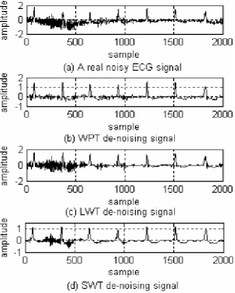 Figure 5.Denoising results using WPT, LWT and SWT on real ECG example. Results from [4]   