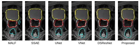 Figure 2: Pelvic organ segmentation results of a typical sub-ject by different methods