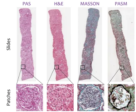 Figure 1: Top: slides from four different staining methods(PAS, H&E, MASSON and PASM, respectively)
