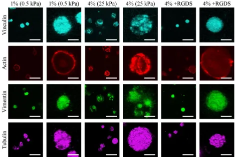 Fig. 3. Representative confocal images of vinculin, actin, vimentin and tubulin in 1 %, 4 % and 4 % +RGDS constructs (scale bars = 50 μm and 12.5 μm).