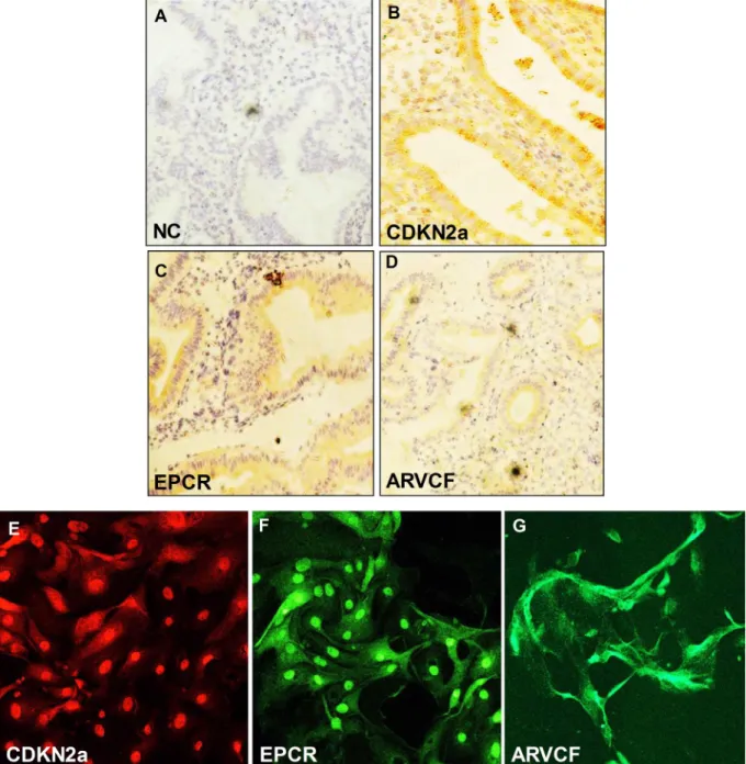 Figure 6:  Immunochistochemical analysis of (A) CDK2a, (B) EPCR and (C) ARVCF expression in endometrial epithelial cells