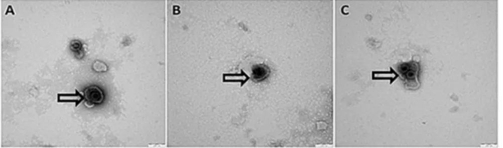 Figure 2: (A, B, C) TEM micrographs of the 4 th  (A), 10 th  (B) and 20 th  (C) OH2 generations