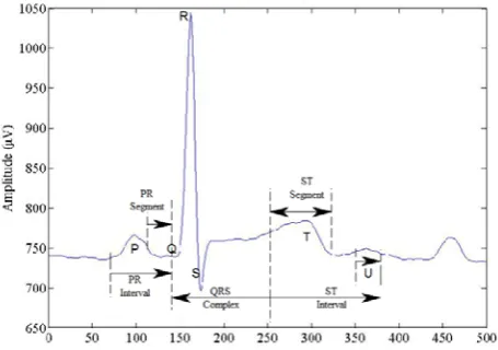 Fig 1. Basic Electrocardiogram (ECG) Signal: wherein P wave represents the atrial depolarization, QRS complex wave represents the ventricular depolarization and T wave represents the repolarization of ventricle