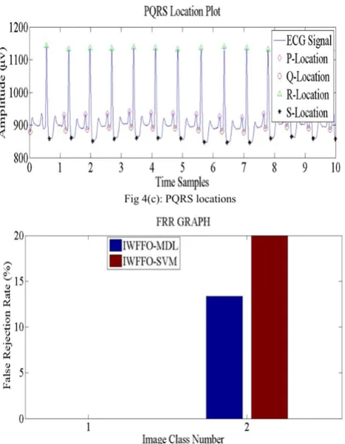 Fig 4(c): PQRS locations 