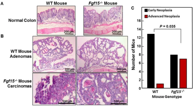 Figure 5: Advanced colon neoplasia in FGF15-deficient mice.  (A) Representative images of normal colons from WT and FGF15-