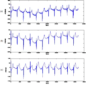 Figure 2: (a) Original or noisy ECG from database; (b) De-noised ECG signal from database; (c) Baseline wander eliminated ECG signal