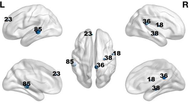 Figure 2: AAL regions exhibiting discriminant functional activity and the associated spatial weights obtained from DTM