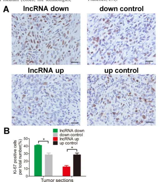 Figure 5: lnc-RAB11B-AS1 inhibits osteosarcoma cells proliferation in vivo.  (A) Immunostaining of Ki-67 in osteosarcoma  slices (magnification, × 400; scale bar, 100 μm)