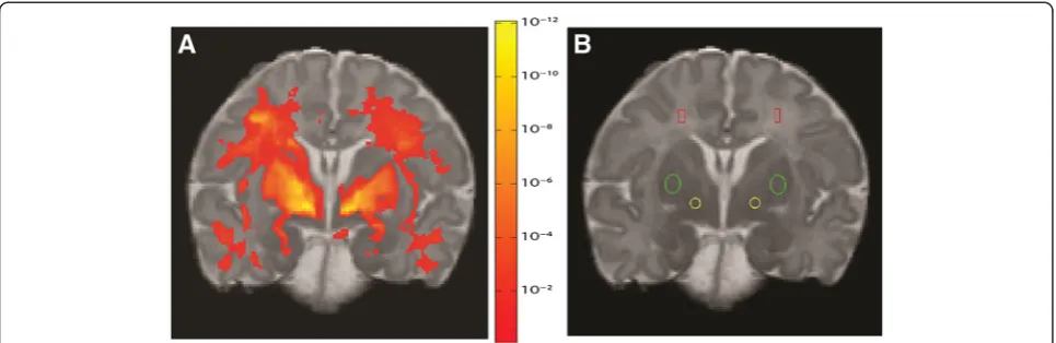 Figure 1 Reference brain section with regions of interest and associations. A: Association between gestational age and T1 relaxation timeacross the study population