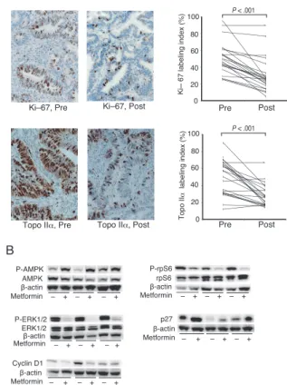 Fig.  4 　Preoperative metformin administration reduces  proliferative  activity  and  alters  cell  proliferation  signaling