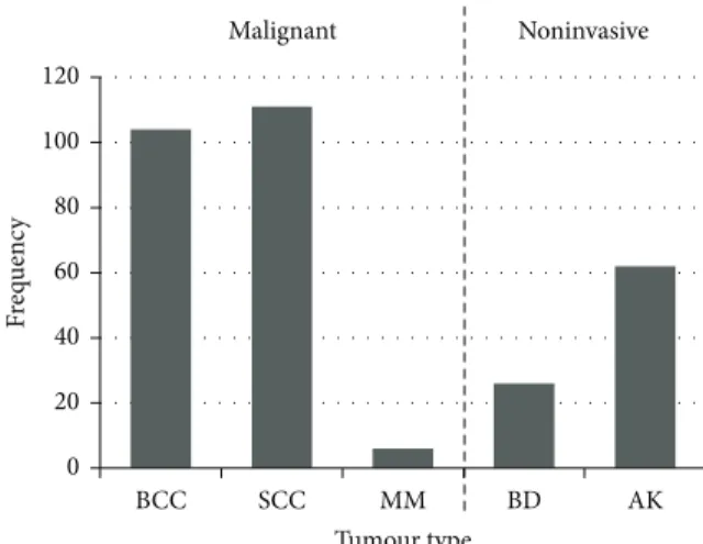 Figure 2: Kaplan Meier survival curve shows two groups—patients with Fitzpatrick skin types I–III (light-skinned—L) with worse times to first malignant tumour and patients with Fitzpatrick types IV–VI (dark skinned—D) where only one malignant tumour occurr