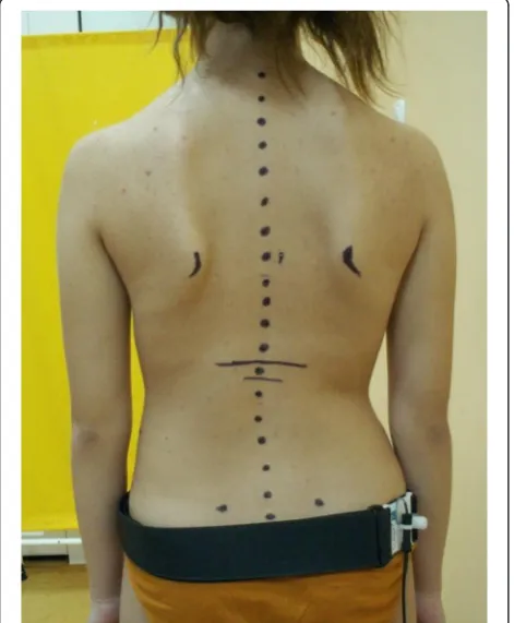 Figure 1 Marking of anatomical skeletal reference landmarks.