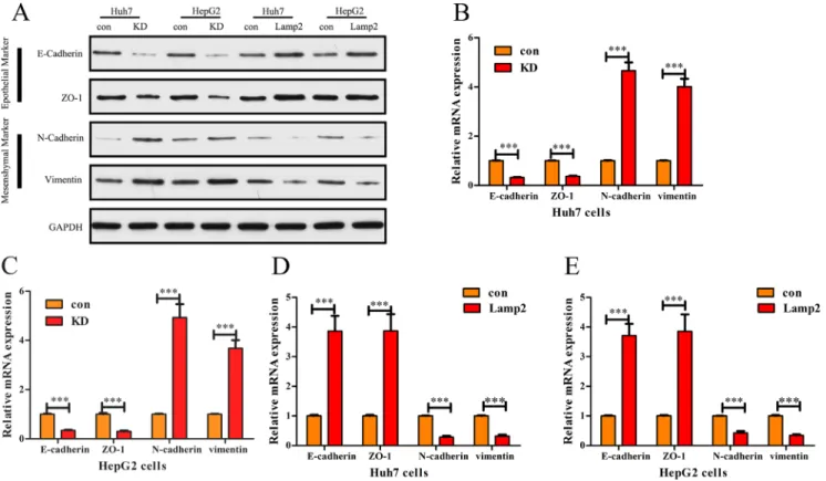 Figure 5: Lamp2 represses the epithelial-mesenchymal transition in HCC cells.  (A, B and C) Western blot analysis and 
