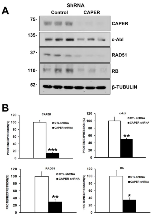 Figure 8: CAPER Knockdown decreases the levels of c-Abl, RAD51 and retinoblastoma proteins, essential proteins  involved in homologous recombination repair of DNA in MDA-MB-231 cells
