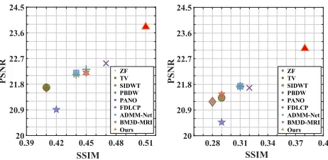 Figure 7: Qualitative comparisons on chest data using Cartesian mask with 30% sampling rate.