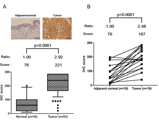 Figure 3: Up-regulation of HSPE1 in individual bladder tumor tissue specimens, determined by IHC