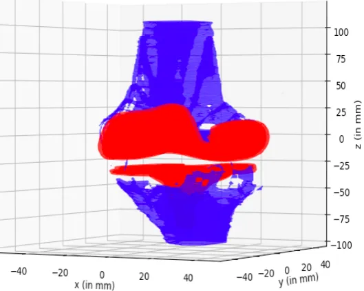 Figure 17: A complete segmentation of a single MRI dataset. All relevant bony and prosthesisstructures have been segmented: femur and tibia (blue), and the femoral and tibial components(red).