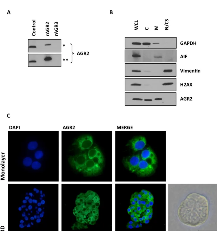 Figure 1: The pattern of AGR2 staining and specificity.  (A) The specificity of Rabbit monoclonal anti-human AGR2 antibody 