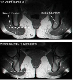Figure 2.15.   MRI showing the effect on the tissues during the application & non-application of load during sitting