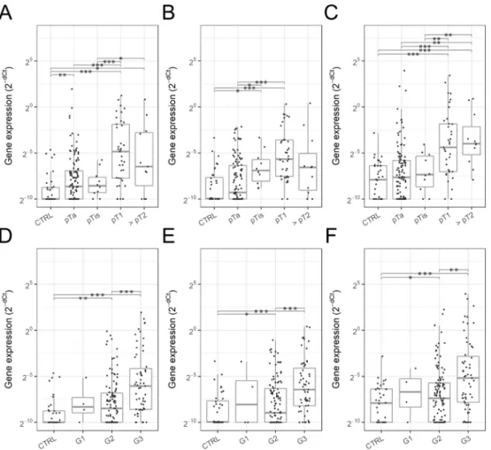 Figure 3: Urinary EV mRNA expression in various stages and grades of bladder cancer.  Expression level of SLC2A1 (A, D), 