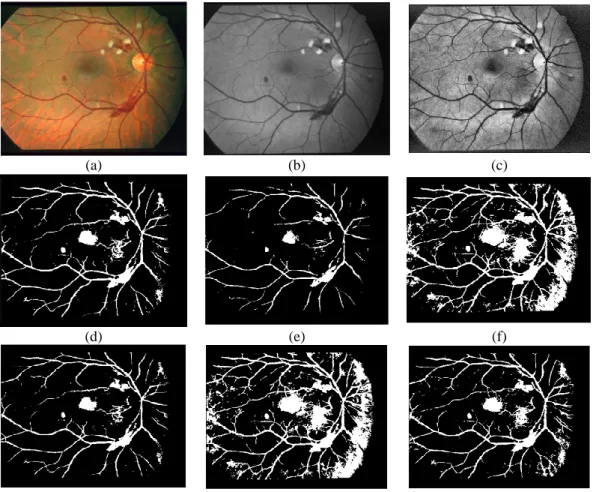 Figure 2. The results of retinal image segmentation with the k-mean algorithm 