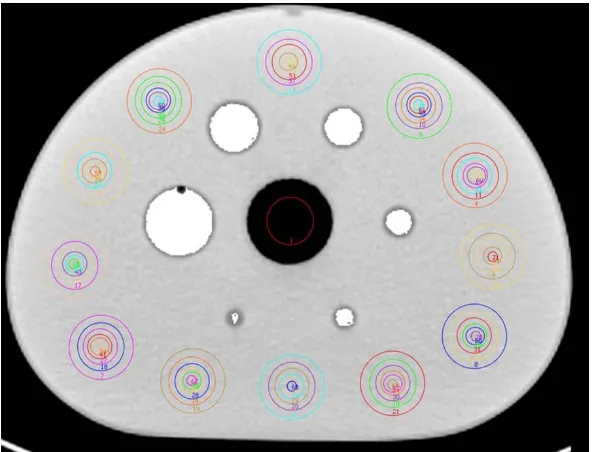 Figure 4. ROI drawn in the background compartment and cold insert, used to determine the background concentration