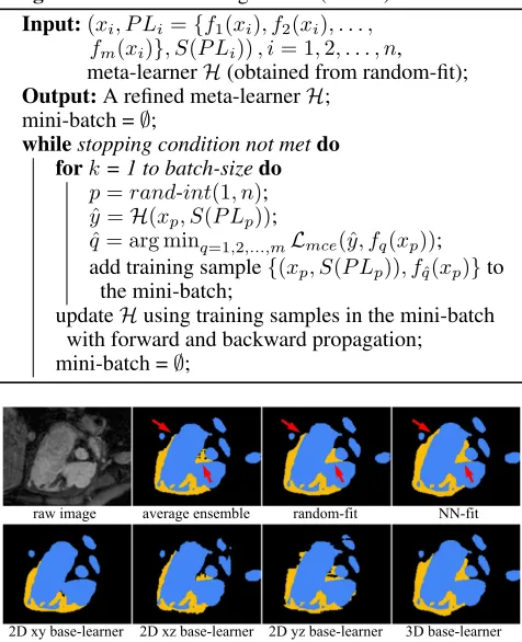 Figure 3: Visual comparison of segmentation results (yel-low: myocardium; blue: blood pool)
