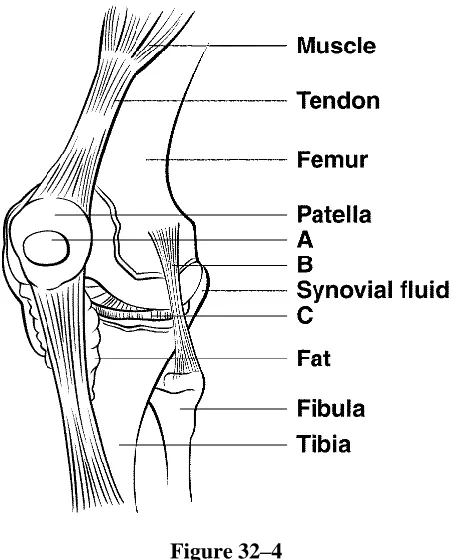 Figure 32–4  