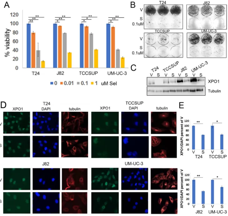 Figure 2: Selinexor reduces bladder tumor cell the viability.  (A) Cell viability assays of four bladder tumor cell lines treated  with different concentrations of selinexor for 72 hours