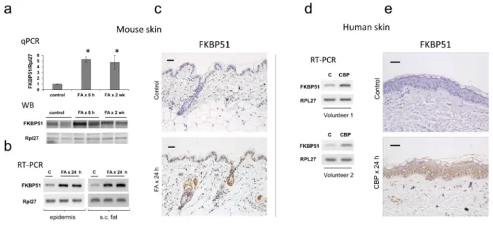 Figure 1: Induction of FKBP51 expression in the skin by glucocorticoids.  F1 C57Bl x 129 WT mice were treated topically with  acetone (vehicle control, C) or glucocorticoid FA (2 μg/animal, for 8 h, 24 h or 2 wk)