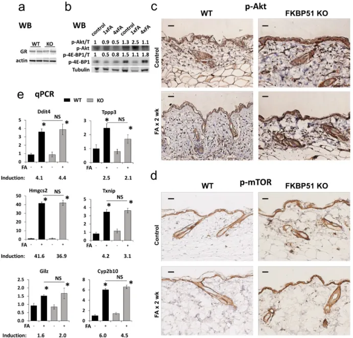 Figure 3: Effects of FKBP51 KO on GR function and Akt/mTOR phosphorylation in murine skin