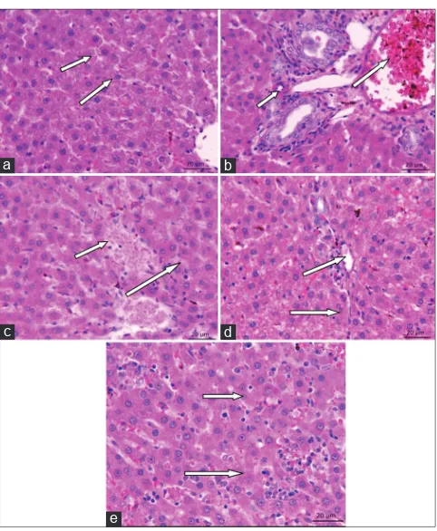 Fig. 8: (a-e) Histopathological observations of Perillyl alcohol (POH) and glibenclamide treated liver in high-fat diet damaged hepatocytes were observed