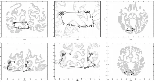 Fig. 4. Locations of the strongest cortical source (peak pseudo-a ‘clock face’ centered on the location of the peak pseudo-(top row) and subject SW (bottom row)