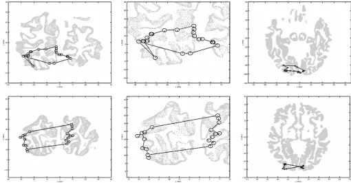 Fig. 8. Locations of the strongest cortical source (peak pseudo-second session with subject SW