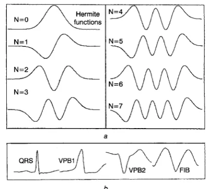 Fig. 1 a functions; b cific application; namely QRSiectopic Hermite functions Plots of the first eight basis functions belonging to the Hermite family of Example of a set of ‘shapes’ to be modelled by Hermite functions for a spe- beat detection 