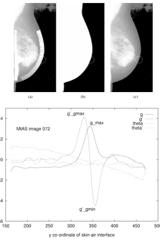 Fig. 5.MIAS image 072 in oblique view with nipple not in proﬁle. (a) The intensities on the original mammogram have been histogram-equalized